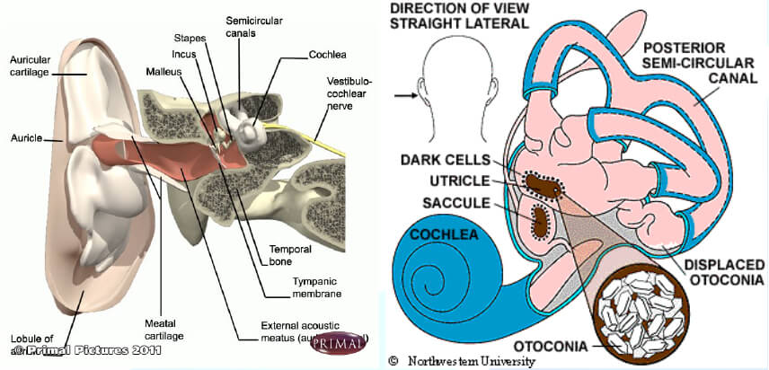 BPPV Or Benign Paroxysmal Positional Vertigo Syndrome 48 OFF
