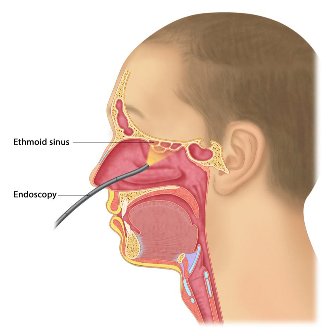 nasal passages