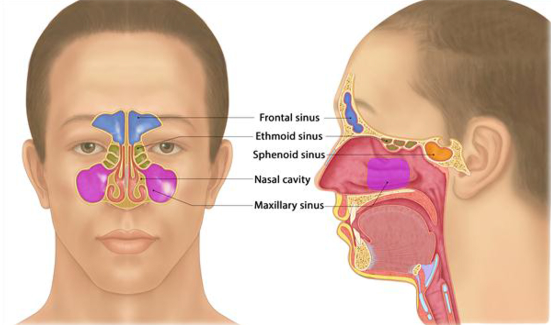 Investing papilloma frontal sinus headache invest certara